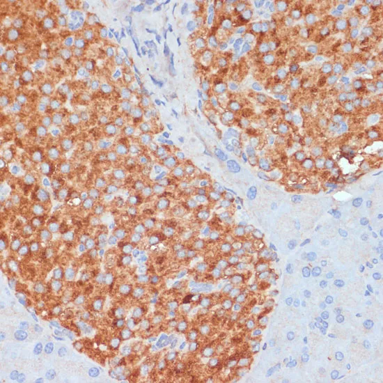 RIP3 Polyclonal Antibody - image 1