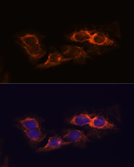 RIP3 Polyclonal Antibody - image 2