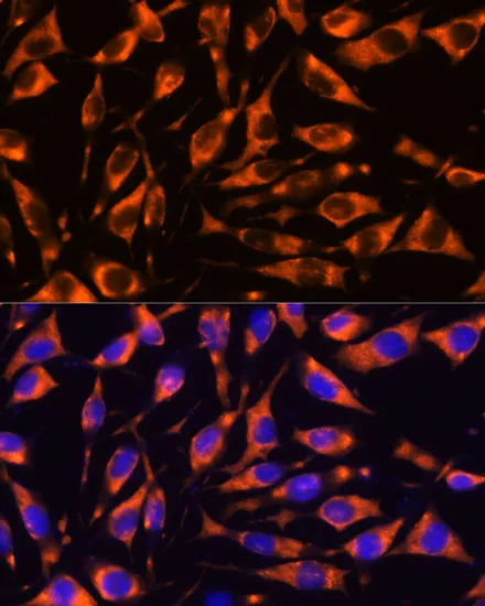 RIP3 Polyclonal Antibody - image 3