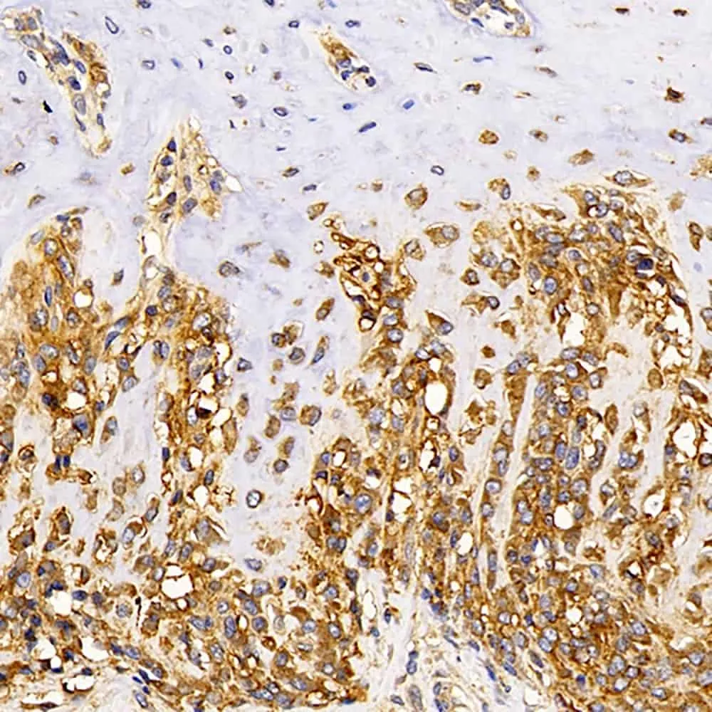 MAGEC1 Polyclonal Antibody - image 1