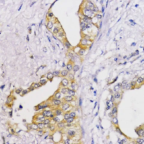 Bcl-2 Polyclonal Antibody - image 2