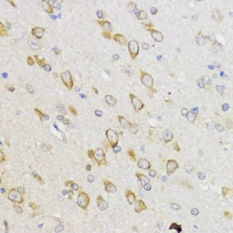 Bcl-2 Polyclonal Antibody - image 3
