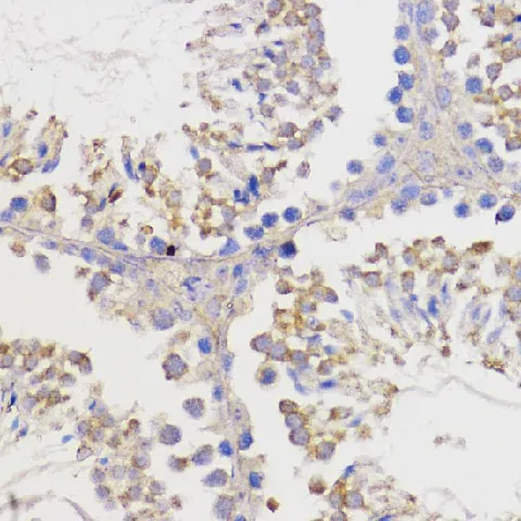 Bcl-2 Polyclonal Antibody - image 4