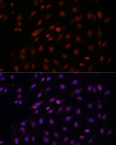 Bcl-2 Polyclonal Antibody - image 5