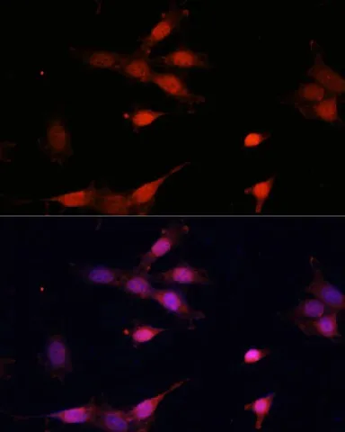 Bcl-2 Polyclonal Antibody - image 6