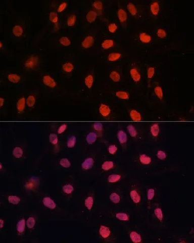 Bcl-2 Polyclonal Antibody - image 7