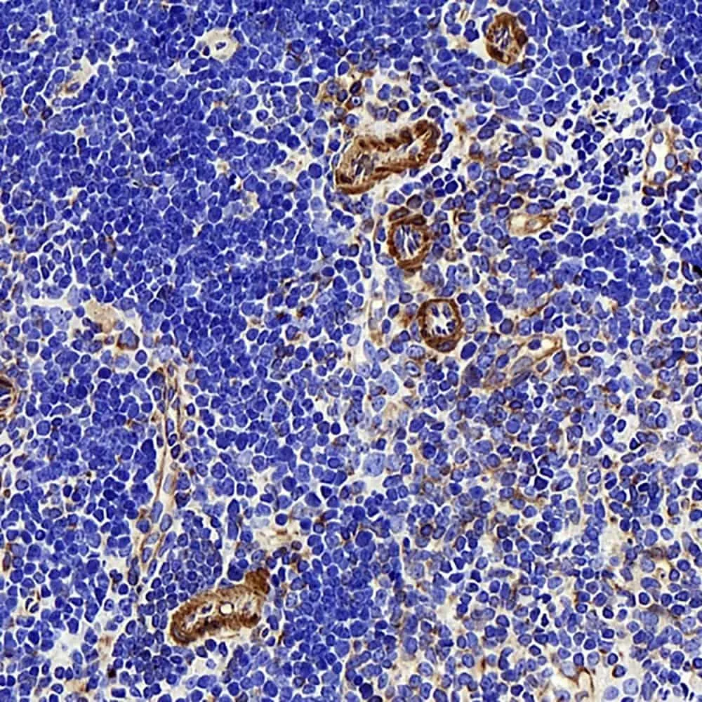 LDLR Polyclonal Antibody - image 1