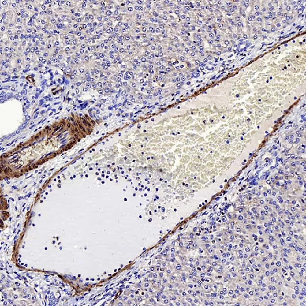 LDLR Polyclonal Antibody - image 2