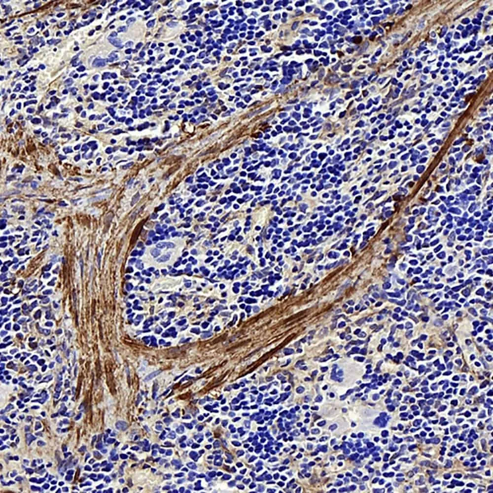LDLR Polyclonal Antibody - image 3