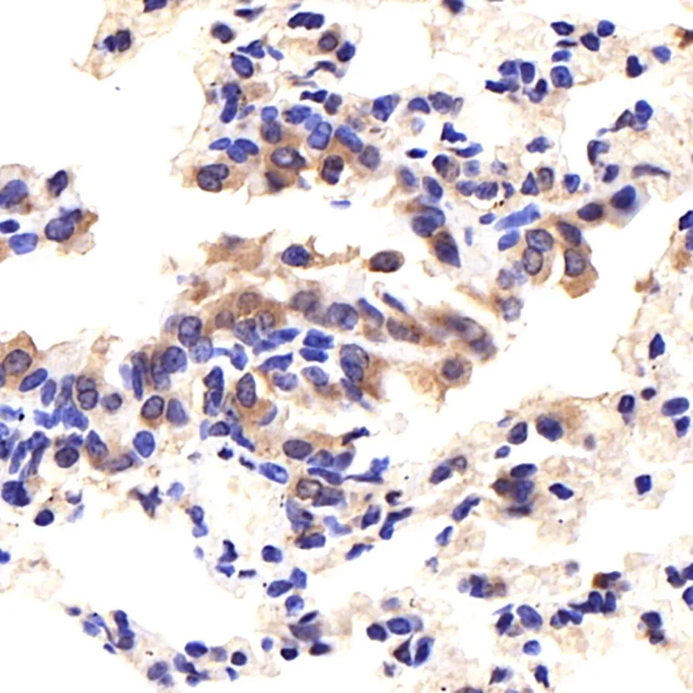 CD14 Polyclonal Antibody - image 1