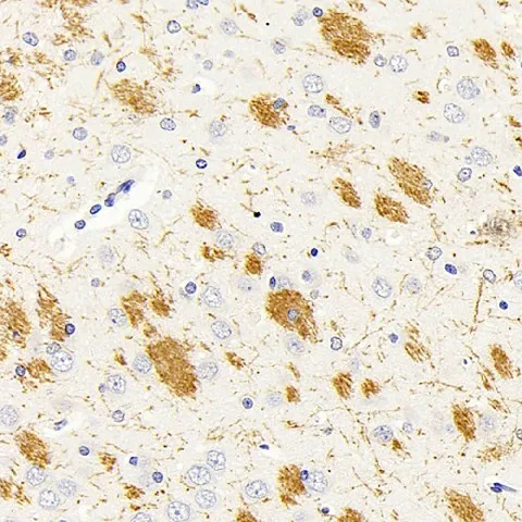 MBP Polyclonal Antibody - image 2