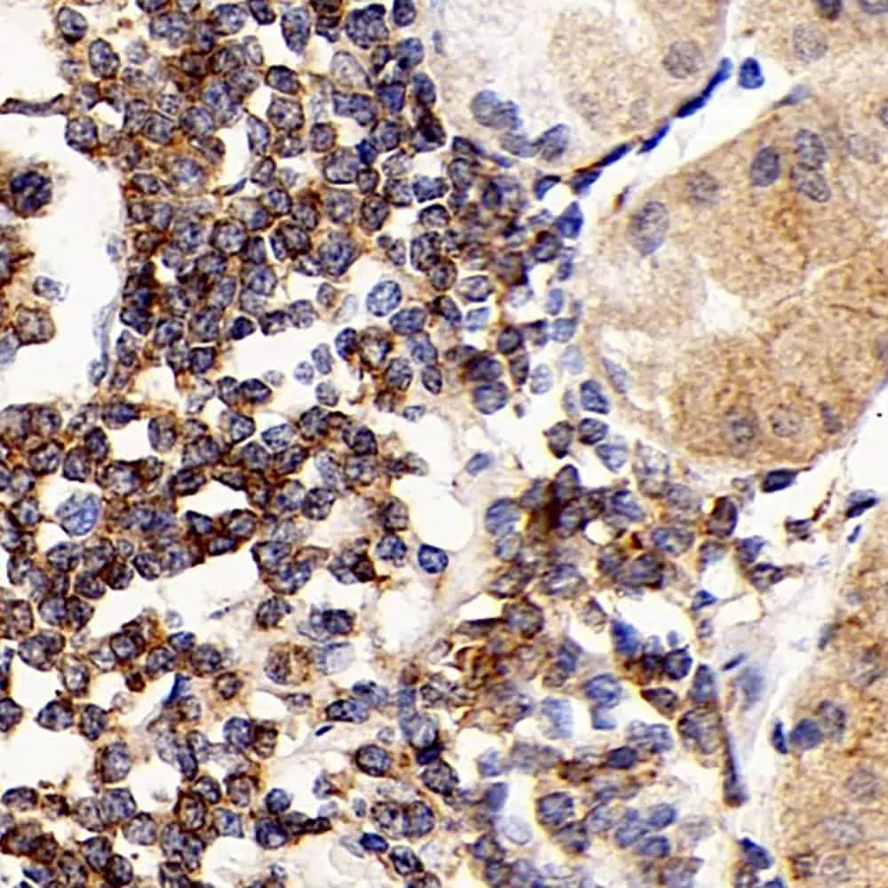 CD192 Polyclonal Antibody - image 1