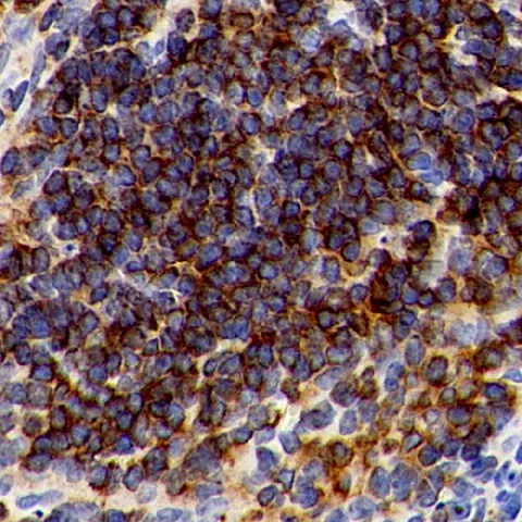 CD192 Polyclonal Antibody - image 2