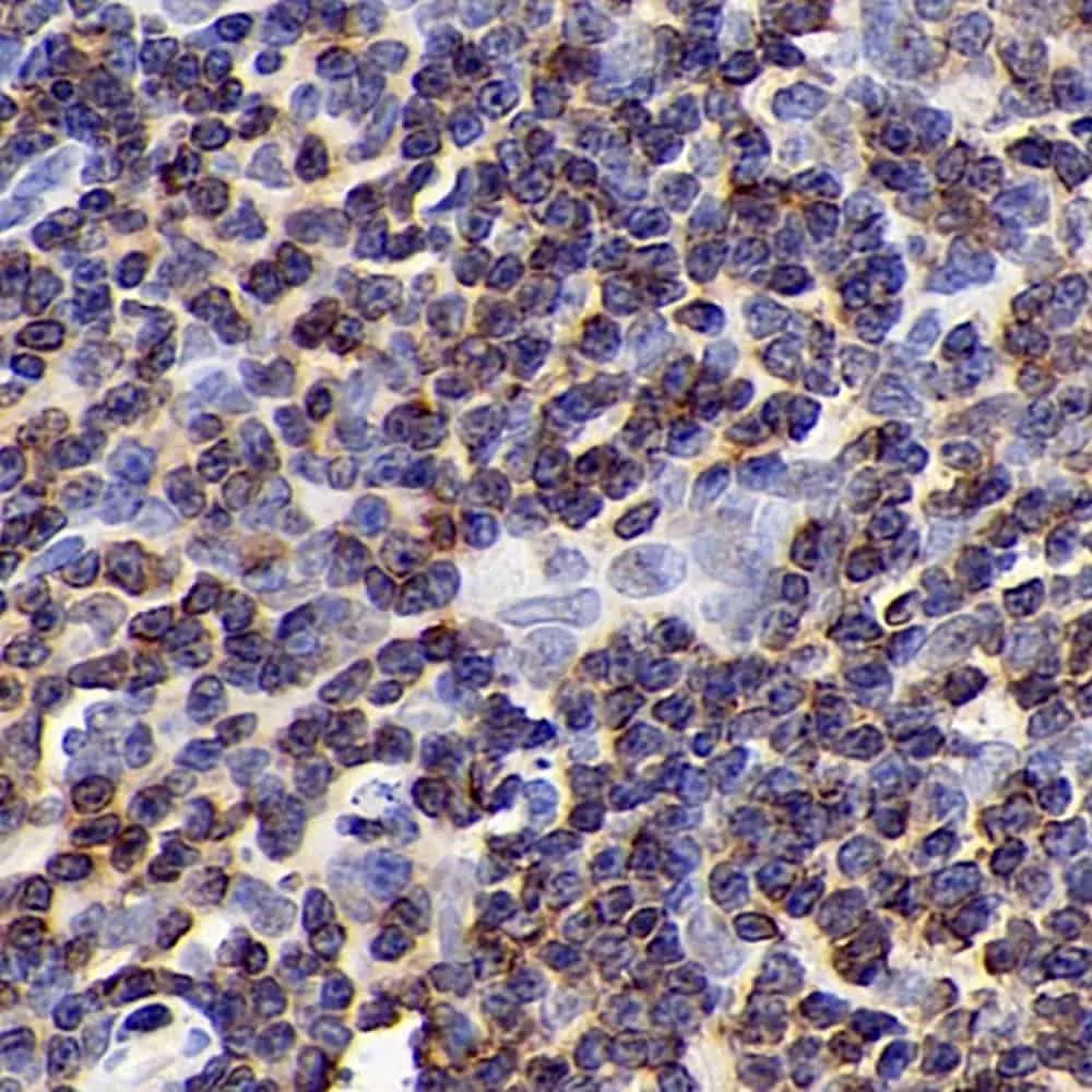 CD192 Polyclonal Antibody - image 3