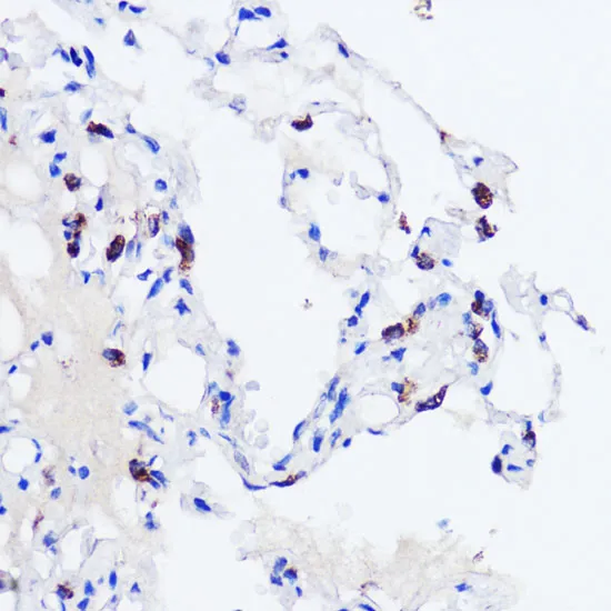 SFTPC Polyclonal Antibody - image 1