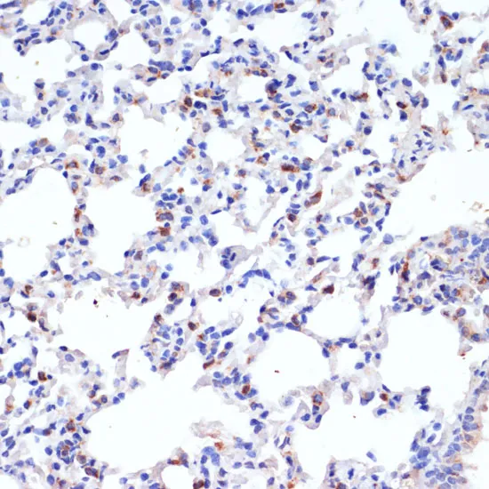 SFTPC Polyclonal Antibody - image 2
