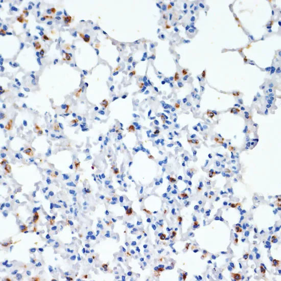 SFTPC Polyclonal Antibody - image 3