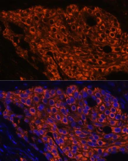 SFTPC Polyclonal Antibody - image 4