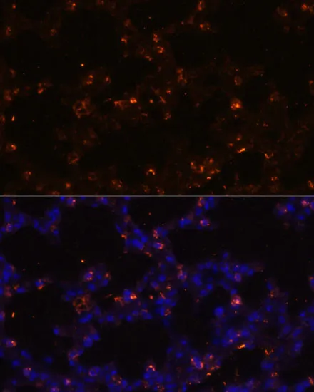 SFTPC Polyclonal Antibody - image 5