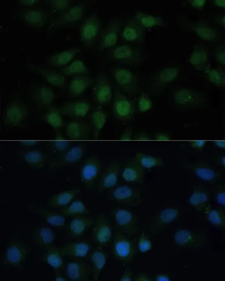 CREB1 Polyclonal Antibody - image 1