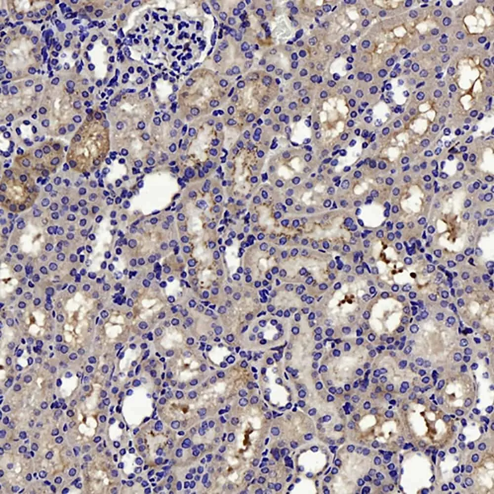 CTGF Polyclonal Antibody - image 1