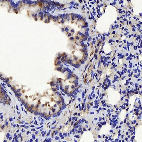 CTGF Polyclonal Antibody - image 2