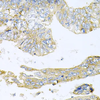 HDAC3 Polyclonal Antibody - image 4