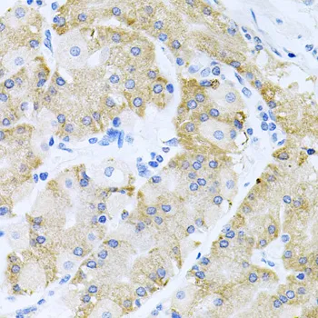 HDAC3 Polyclonal Antibody - image 5