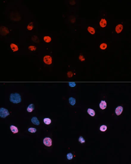 HDAC3 Polyclonal Antibody - image 6