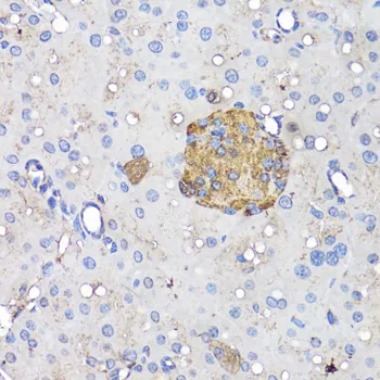 INS Polyclonal Antibody - image 1