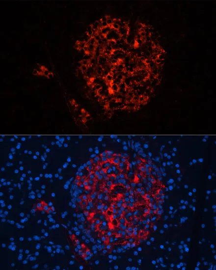 INS Polyclonal Antibody - image 2