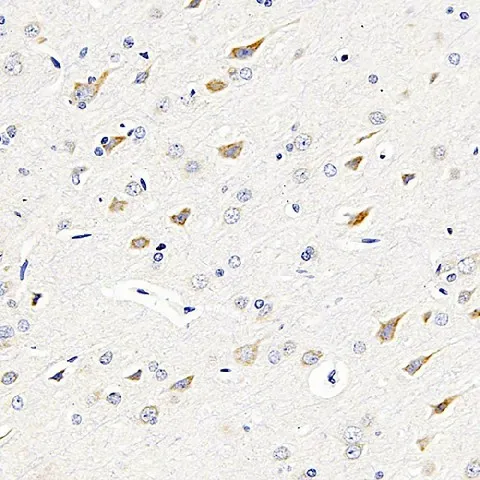 GRIN2B Polyclonal Antibody - image 1