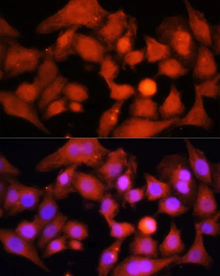 PGC1 alpha Polyclonal Antibody - image 1