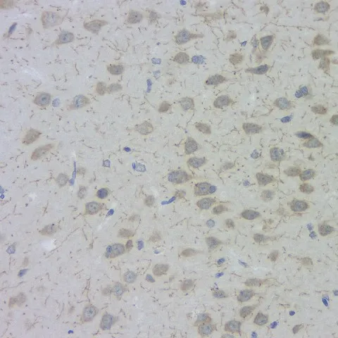ACHE Polyclonal Antibody - image 1