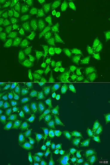 STAT5A Polyclonal Antibody - image 1