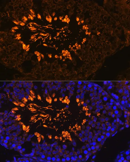 AKAP4 Polyclonal Antibody - image 1