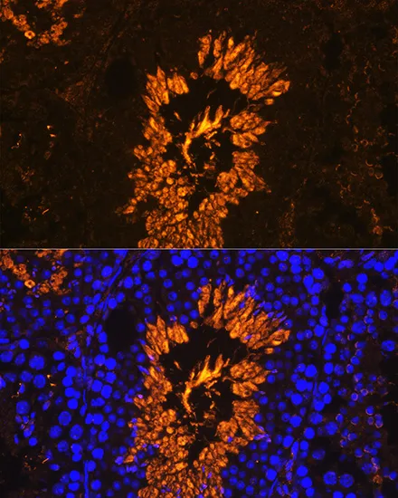 AKAP4 Polyclonal Antibody - image 2