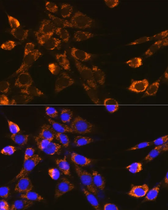 Integrin-β1/CD29 Polyclonal Antibody - image 2