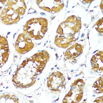 (KO Validated) BAX Polyclonal Antibody - image 5