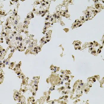 FGF2 Polyclonal Antibody - image 1