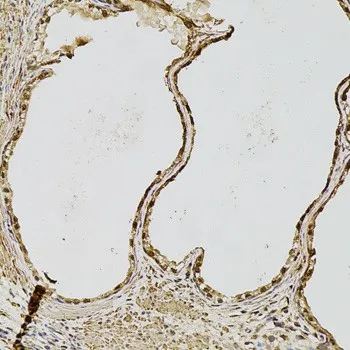 FGF2 Polyclonal Antibody - image 2