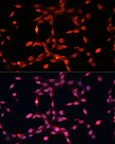 FGF2 Polyclonal Antibody - image 5