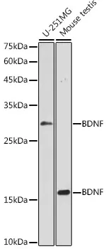 BDNF Polyclonal Antibody - image 1