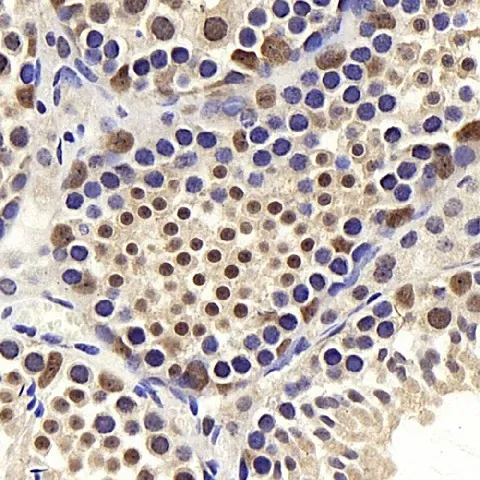BRAF Polyclonal Antibody - image 1
