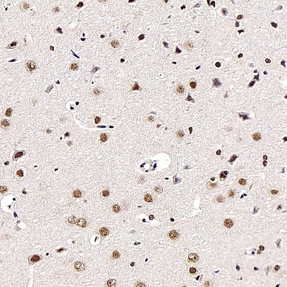 BRAF Polyclonal Antibody - image 2
