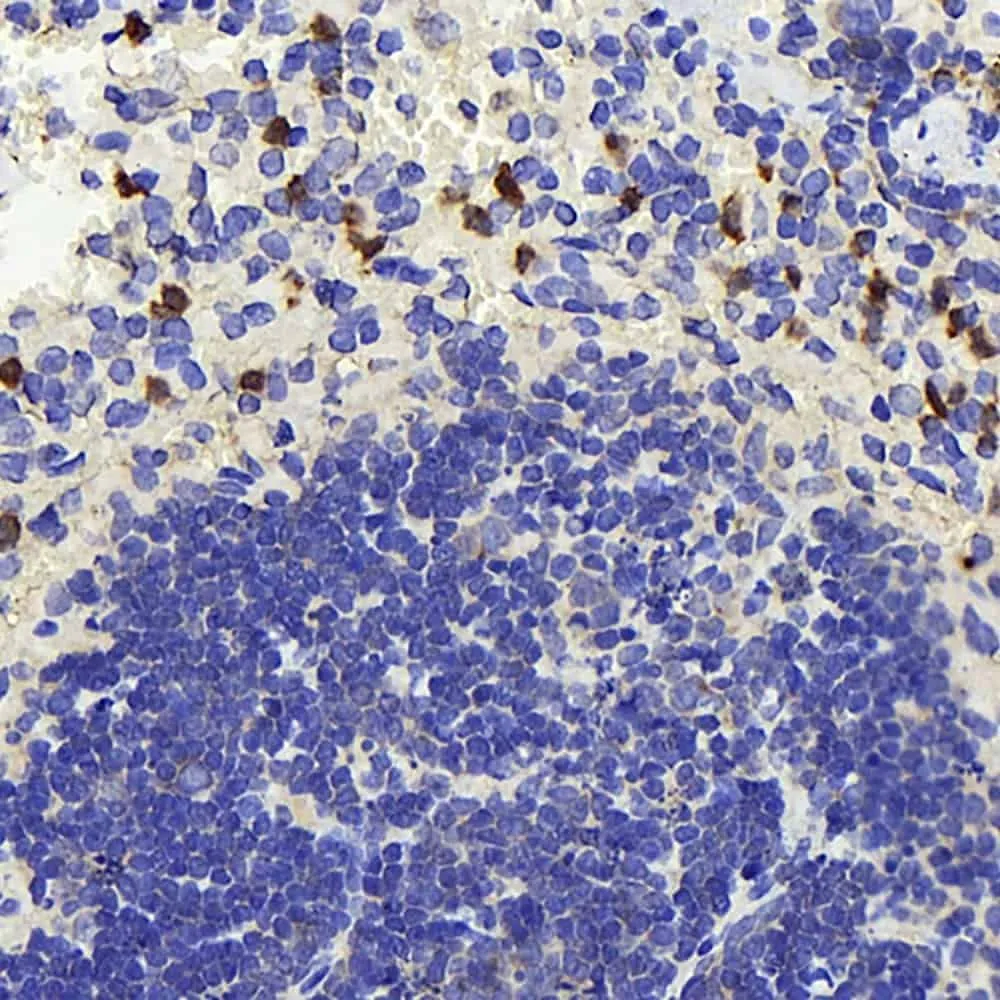 TSC22D3 Polyclonal Antibody - image 1