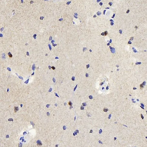 TSC22D3 Polyclonal Antibody - image 2