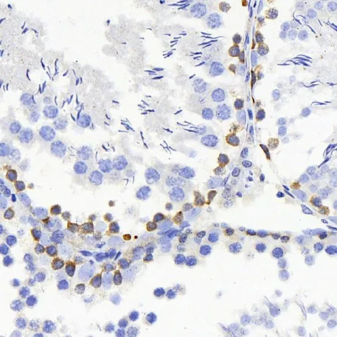 TSC22D3 Polyclonal Antibody - image 3