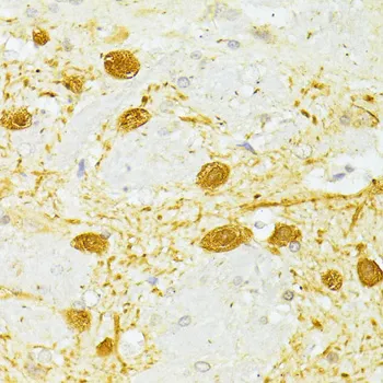PVALB Polyclonal Antibody - image 1