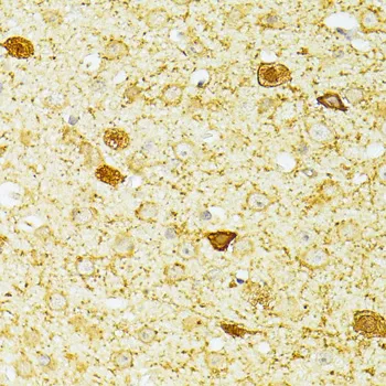 PVALB Polyclonal Antibody - image 2